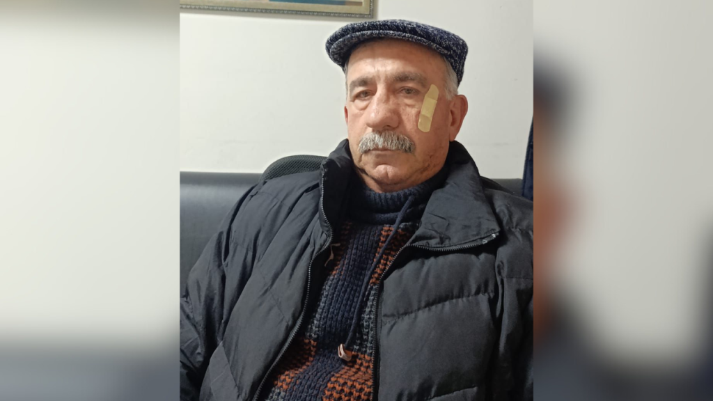 Lapseki'de AK Partili meclis üyeleri gazeteciyi darp etti!