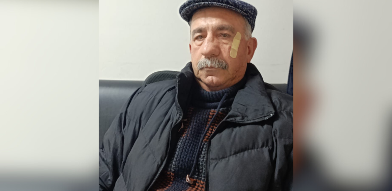 Lapseki’de AK Partili meclis üyesi ve yönetici gazeteciyi darp etti!