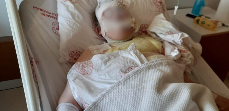 Çanakkale’de eşi tarafından yakıldığı iddia edilmişti: Yeni ifadeler ortaya çıktı